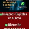 Radiografias a Domicilio SF